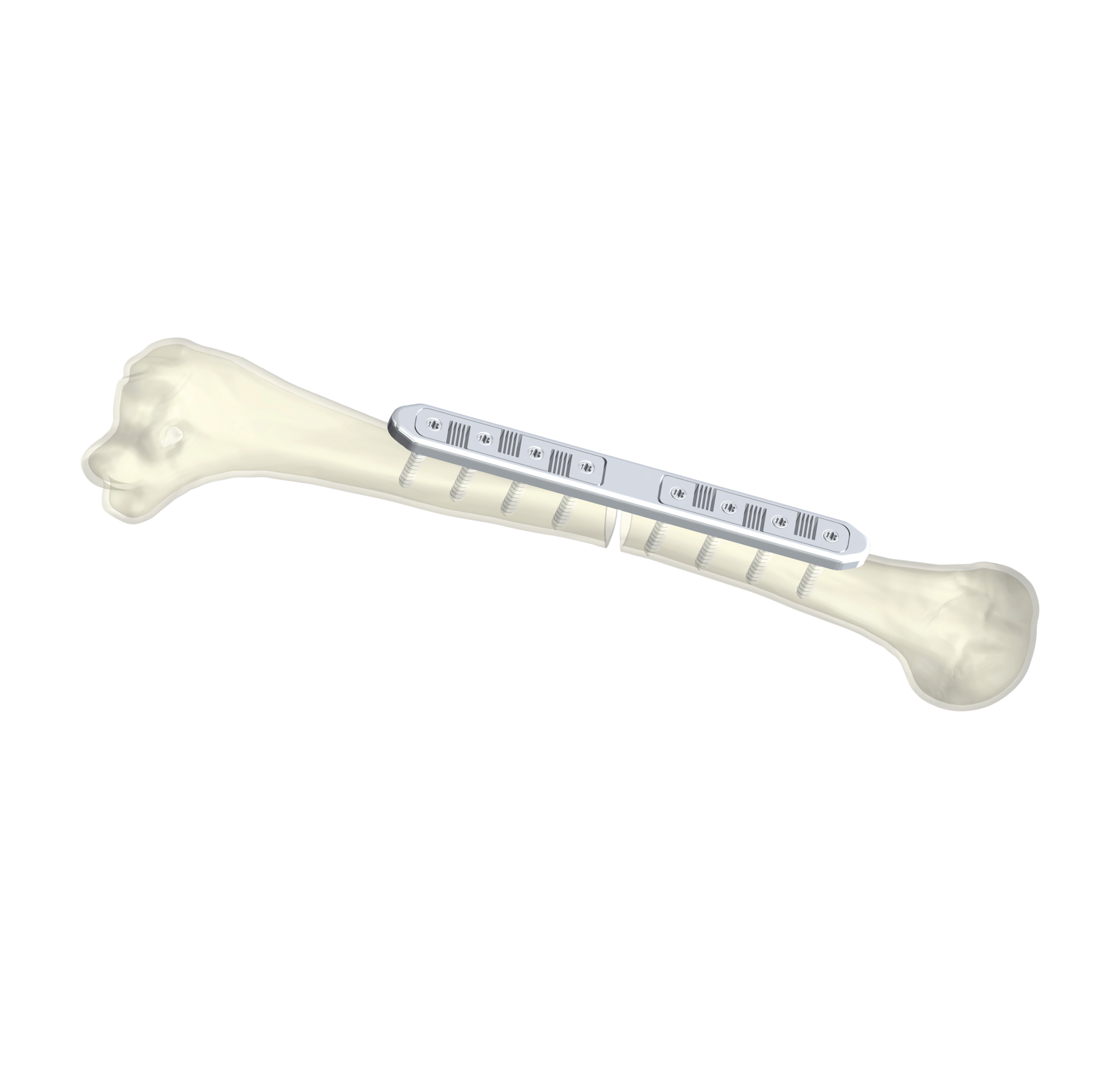 Illustration of the Axiflex Device